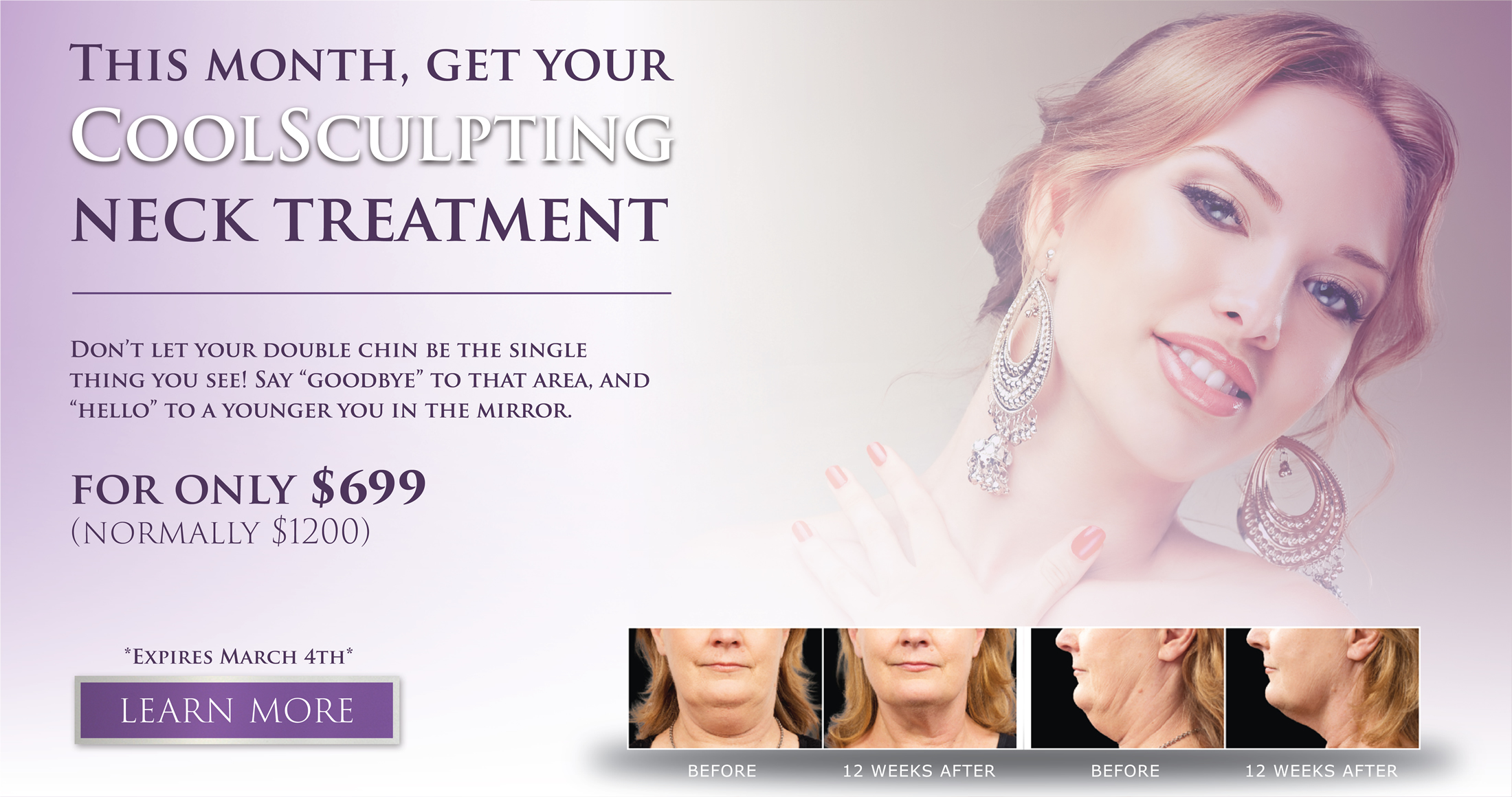 coolsculpting-slide-march