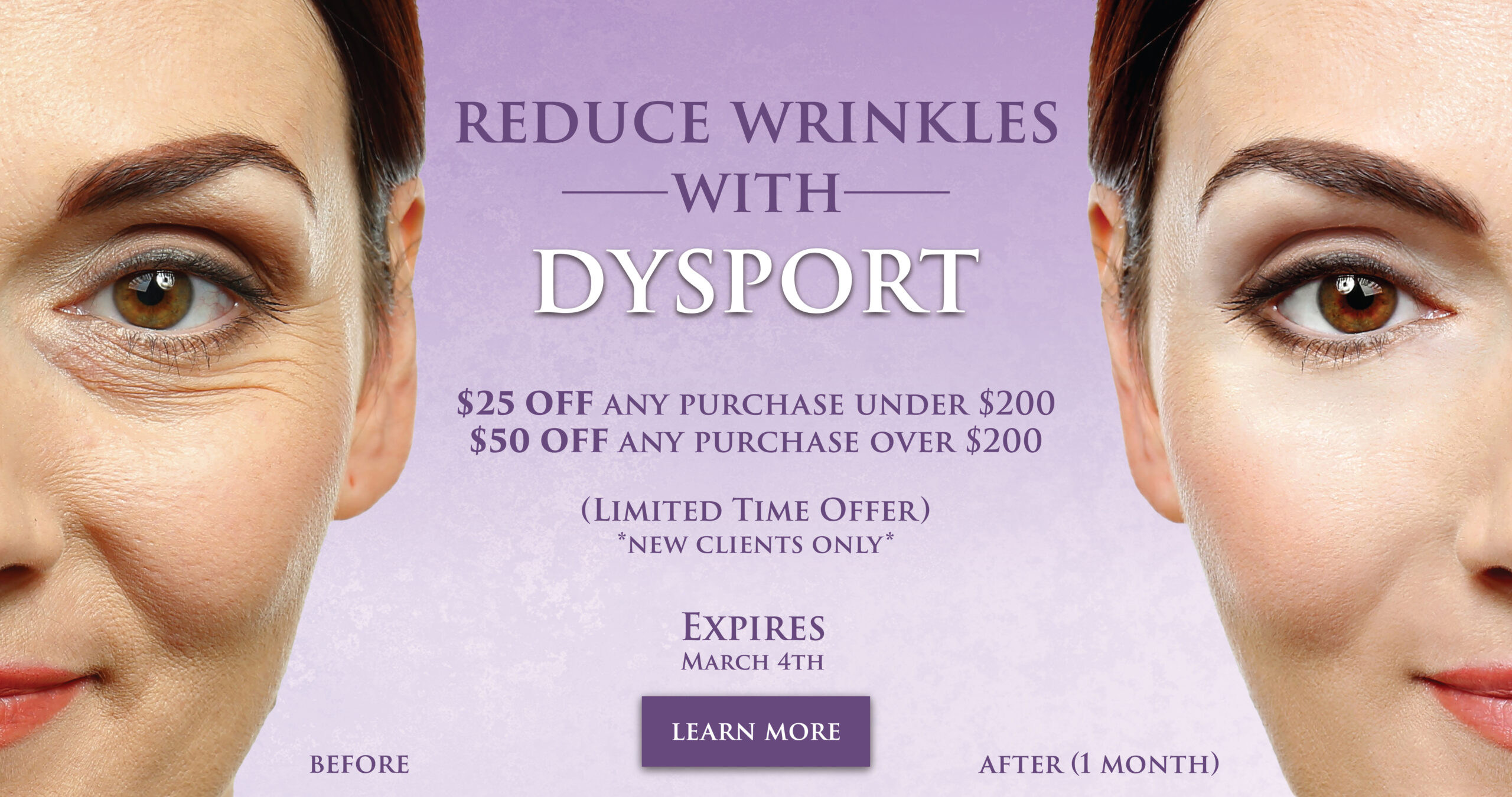 dysport-march