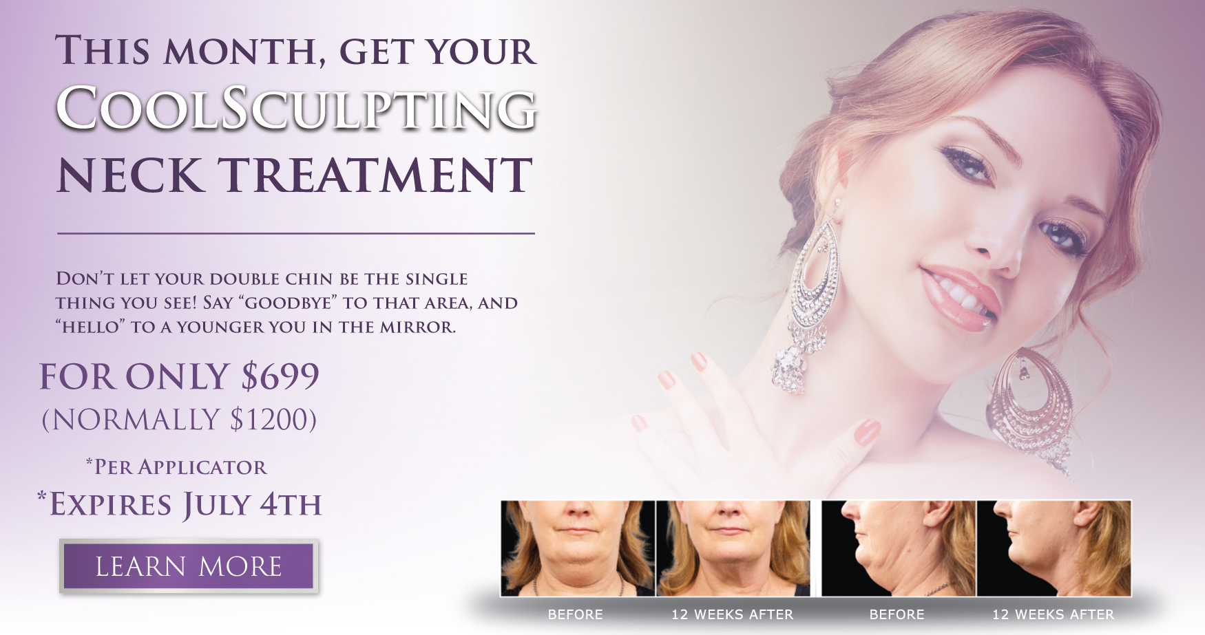 coolsculpting-july