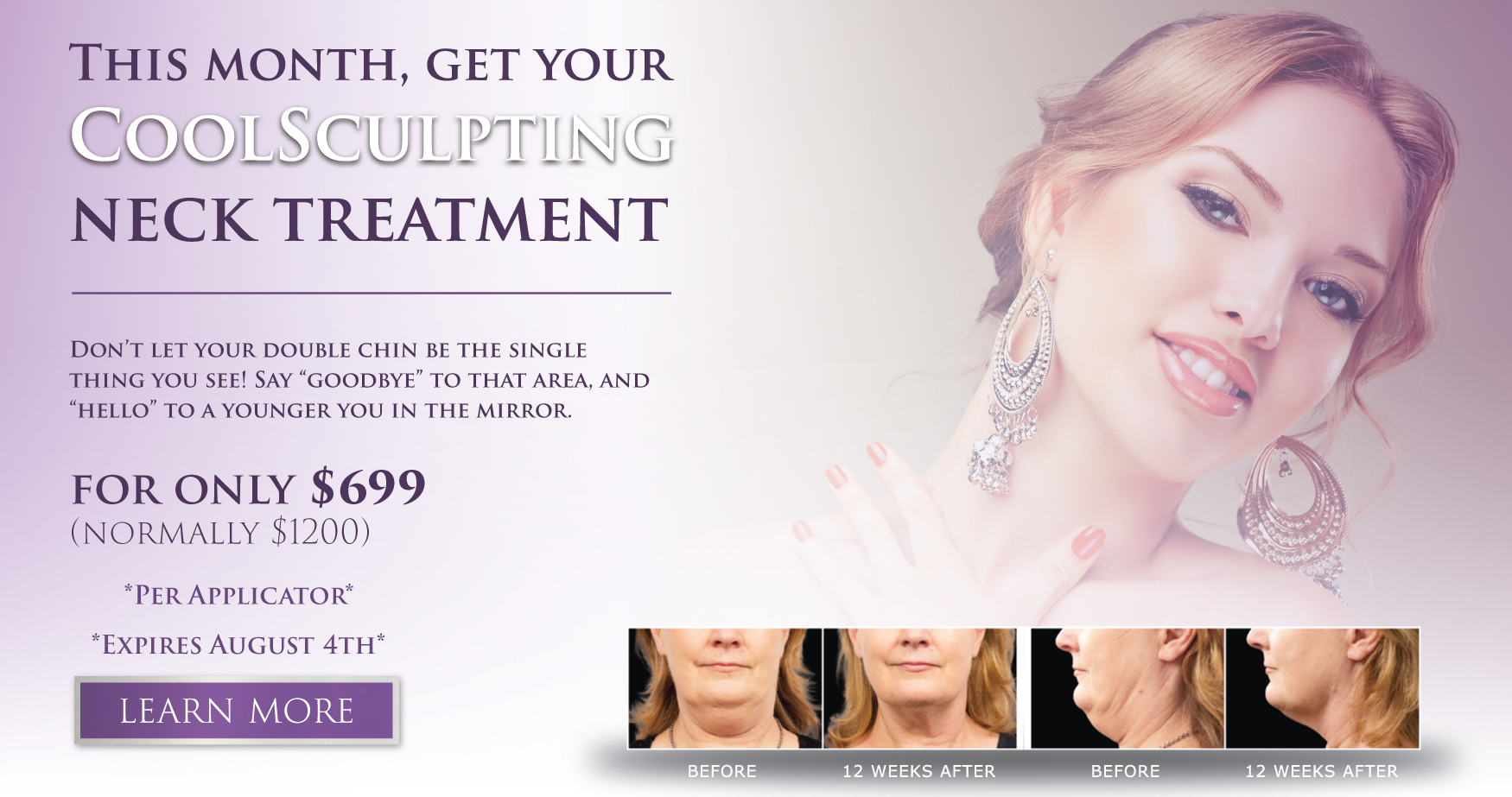 coolsculpting-august