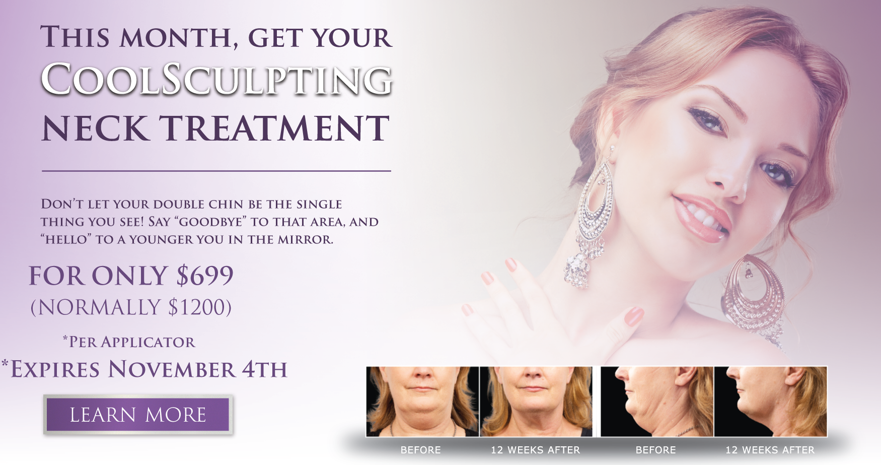 coolsculpting-july