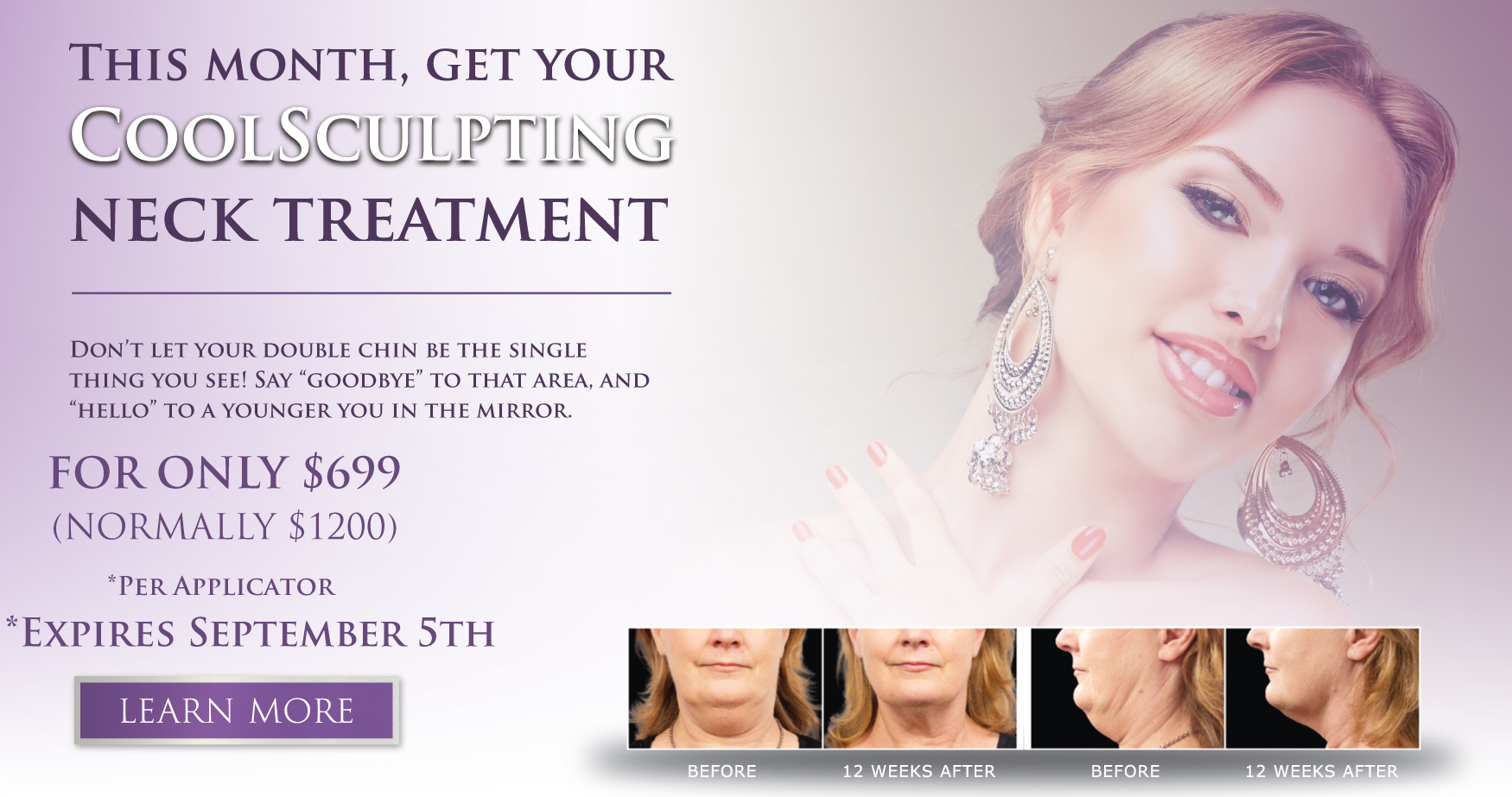 coolsculpting