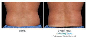 B&A-Bowes-FL-2Set-8wk-Back-LoRes