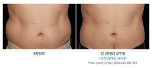 B&A-DiBernardo-AB-2Set-12wk-LoRes