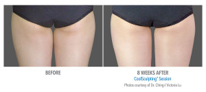 B&A-Lu-INTH-2Set-8wk-Back-LoRes