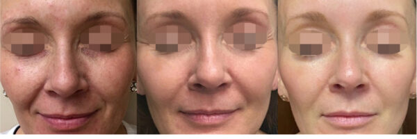 Skin Radiant Complexion
