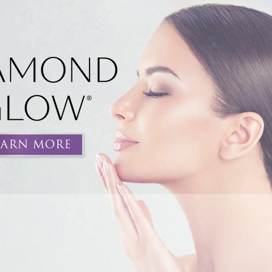 Diamond Glow in Schaumburg banner image